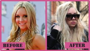 Amanda-Bynes-Plastic-Surgery-Before-And-After CelebReligions